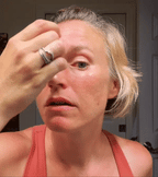 ONE | The Clinical Facial Treatment™